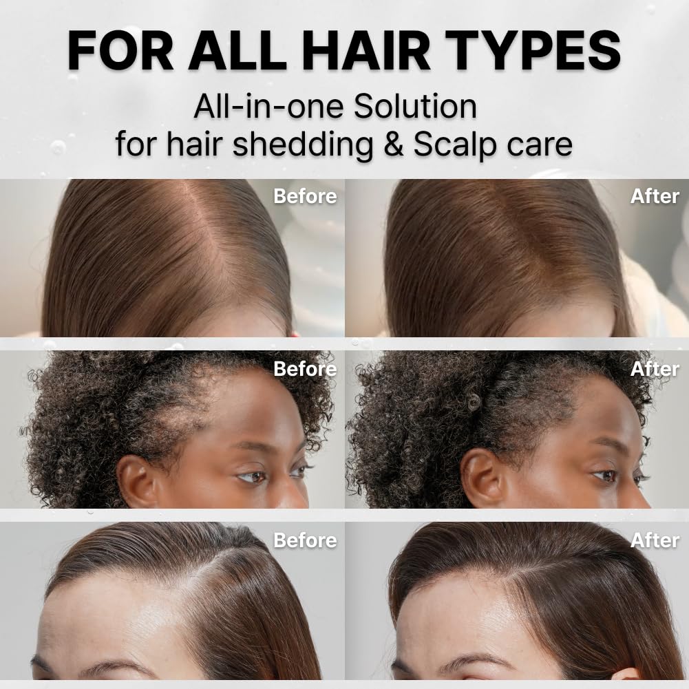 lilyeve Wachsen:TURN Haarausfall Bürstenampulle 100 ml – Kopfhautpflege-Set (+ 100 ml Nachfüllung)