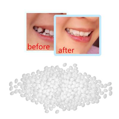 Faccette dentali