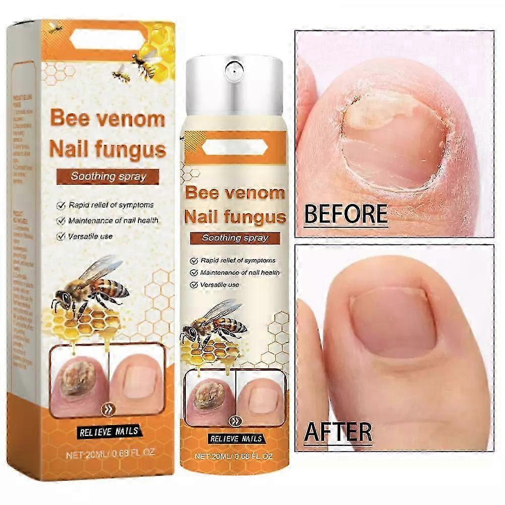 Suitable for Nail Repair Serum, Bee Venom Care Spray, Ingrown Toenail Solution