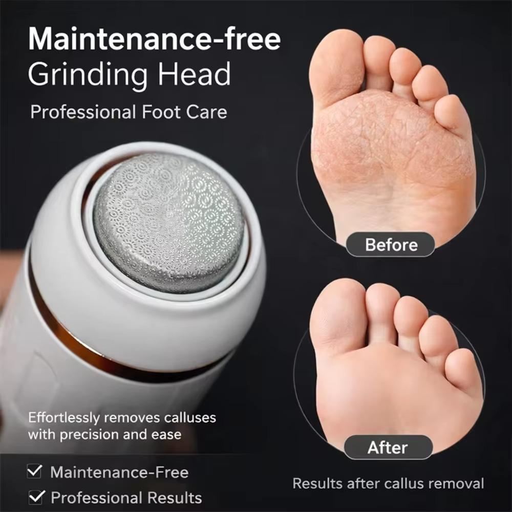 Portable Electric Feet Callus Remover Electric Callus Remover Kit  for Smooth and Soft Feet