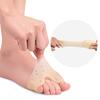 Sebs Magnet Toe Splitter Thumb Valgus Big Foot Bone Orthosis Size Toe Overlap Splitter Forefoot Pad