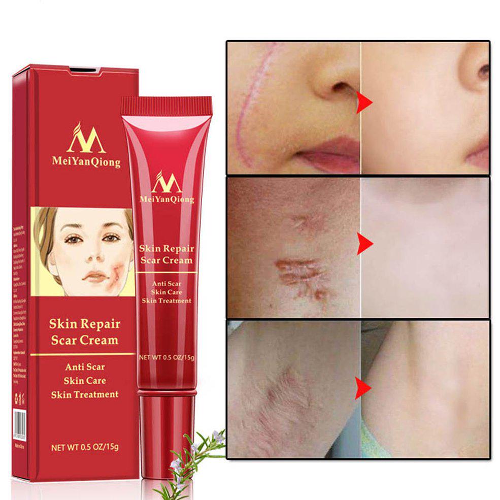 fast acne scar removal cream