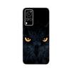 Transparent Tpu Coque Cover For Vivo X60 Pro Case High Quality Luxury Silicone Soft Phone Case For Vivo X60 4G 5G X60T X 60 Case
