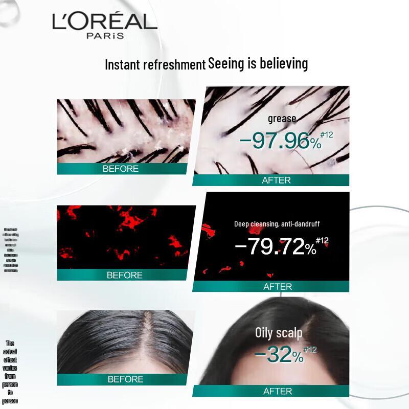 L'Oréal Scalp Oil Control & Volumizing Shampoo