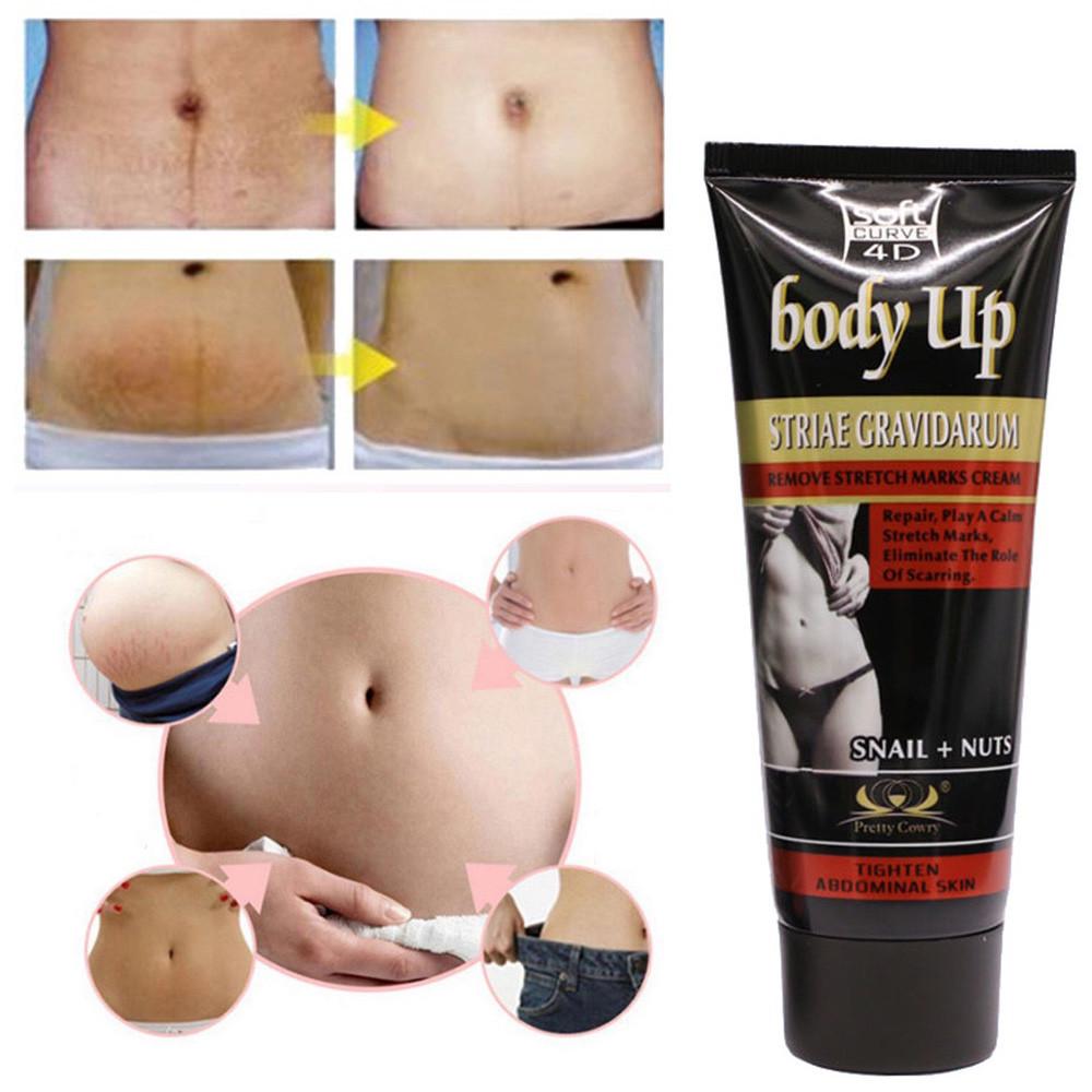 striae gravidarum cream