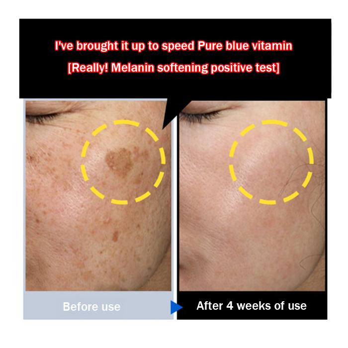 Blue Vita C Ampoule Corrector