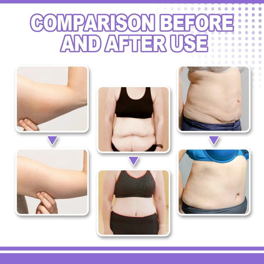 Collagen Body Cream Lifting Firming Arm Cream Tightening Weight Loss Sculpting Massage Sliming Cream Skin Care Tools