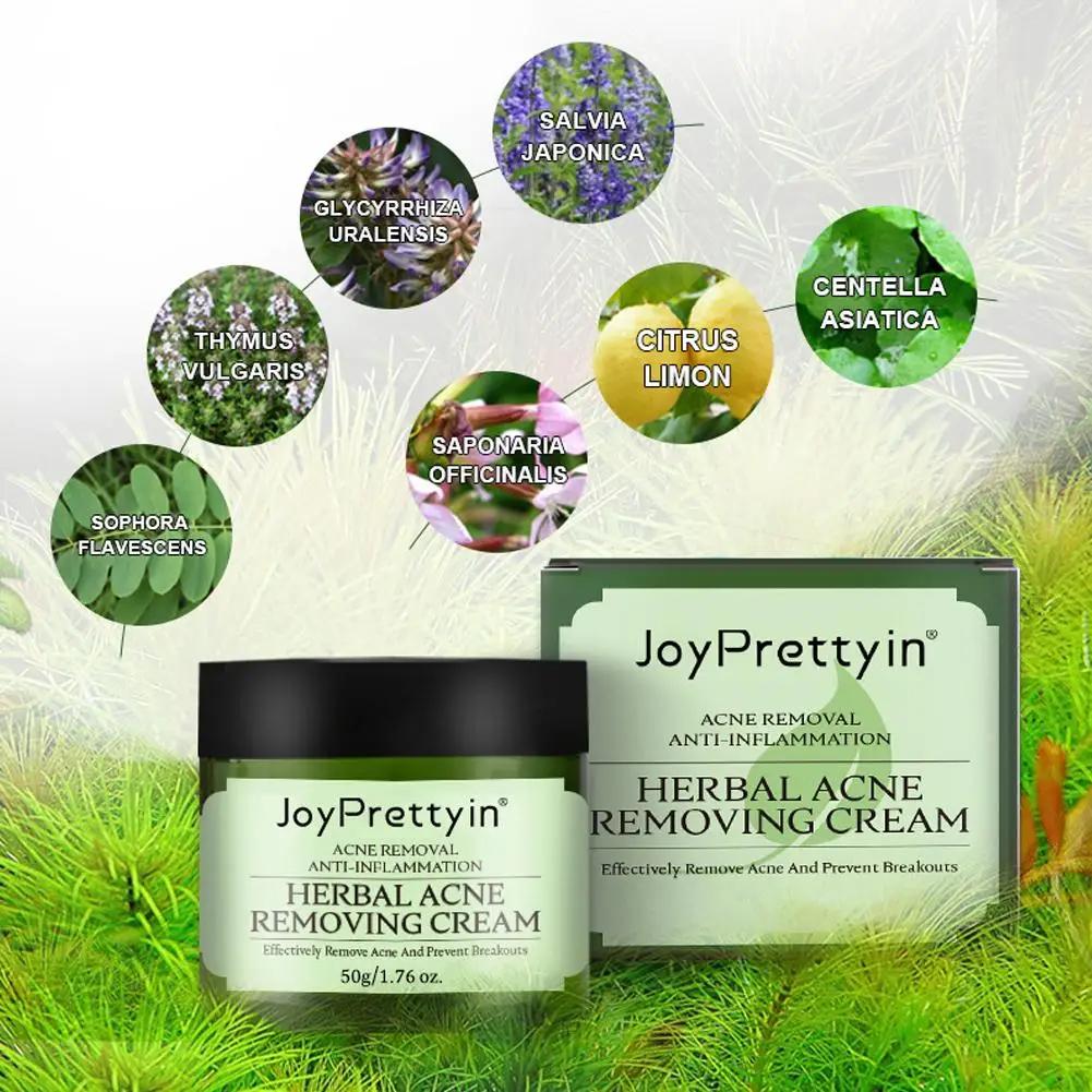 Crème anti-acné pour le visage, élimine les pores dilatés, traite l'acné, contrôle du sébum, réduit les pores, crème pour le visage, soins de la peau, beauté et santé