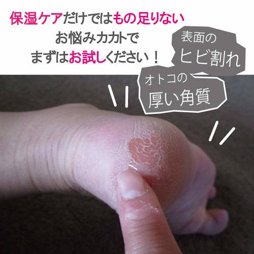 PERFECT NAILS Foot File, Waterproof, Callus Removal Tool for Heels and Bath (Red)