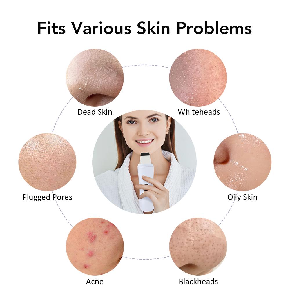 EMS Vibration Face Skin Scrubber Blackhead Remover Facial Pore Cleaner Face Lifting Deep Clean Face Skin Tool Face Spatula