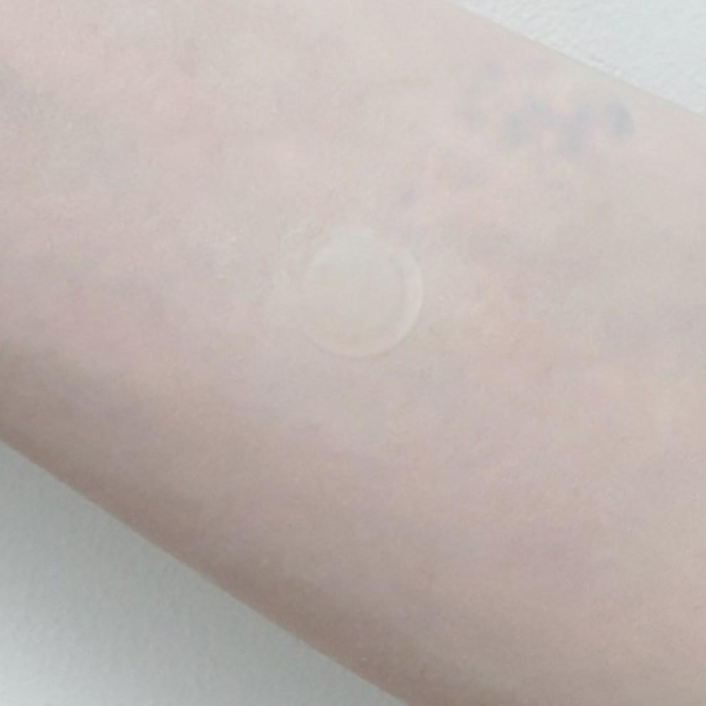 Perfekte Lösung Pickel-Patch 120 Stück