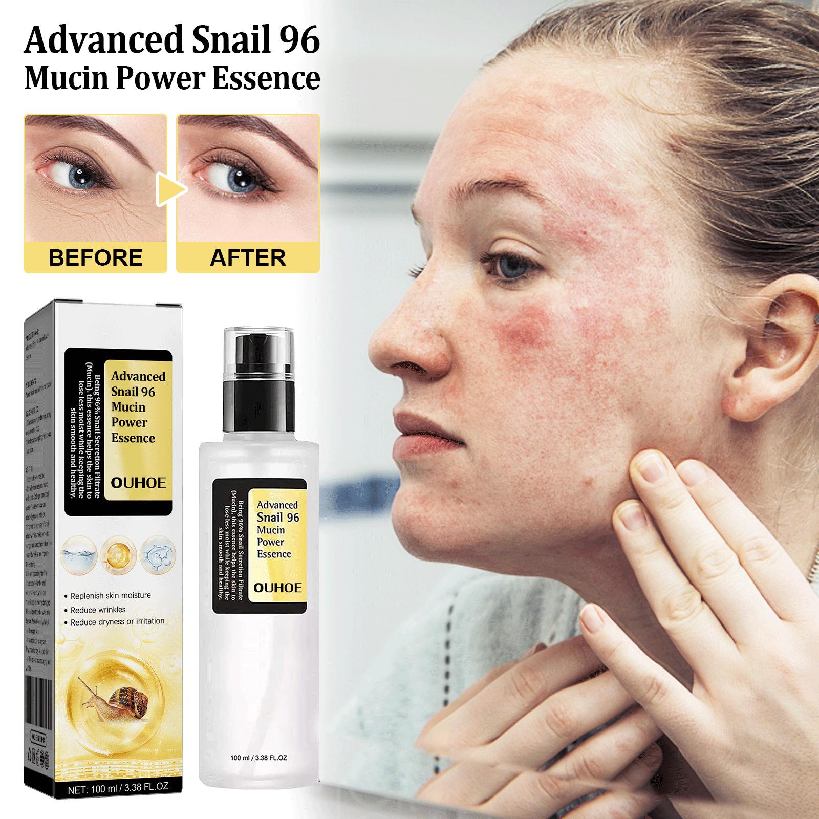 

Snail 96 Collagen Power Serum, Hydrating And Moisturizing, Repairing The Skin Barrier And Fading Dark Spots 100ml
