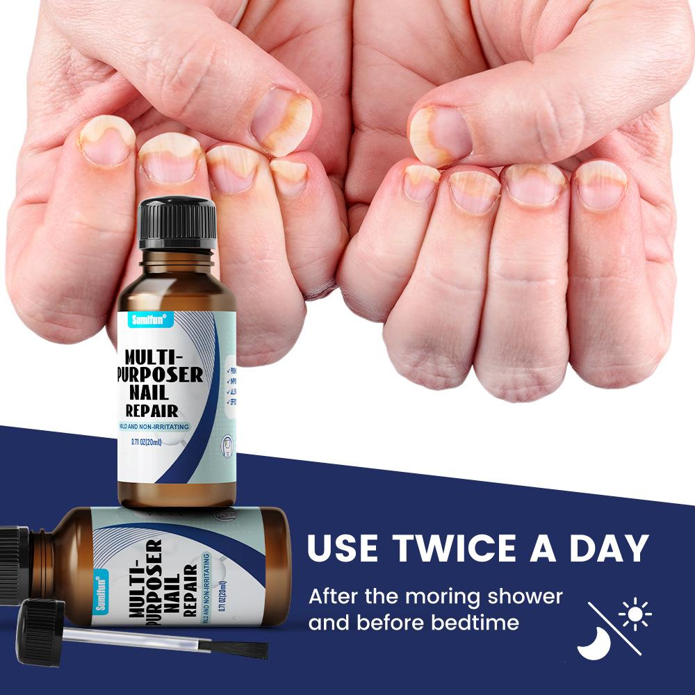 Gray Nail Paste, Thickened Shiny Nail, Gray Nail Repairs, Clean and Soft Nail Paste, Care for Hand, Foot and Toenail Decay