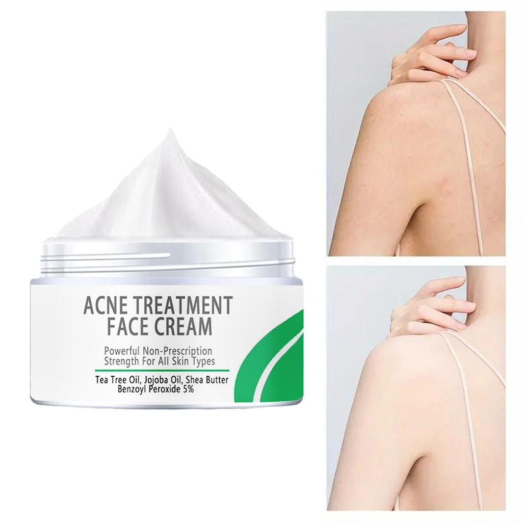 Whitening Skin Oil Control Cover Pores Acne Skin Whitening Cream