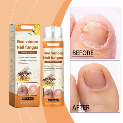 Nail Care Spray Foot Nail Cleaning And Moisturizing Nail Care Spray 20ml
