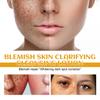 Intensive Spot Lightening Cleansing Milk for Deep Facial and Body Cleansing