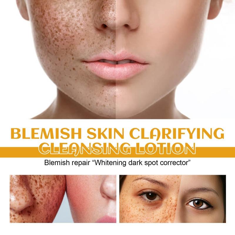 Intensive Spot Lightening Cleansing Milk for Deep Facial and Body Cleansing