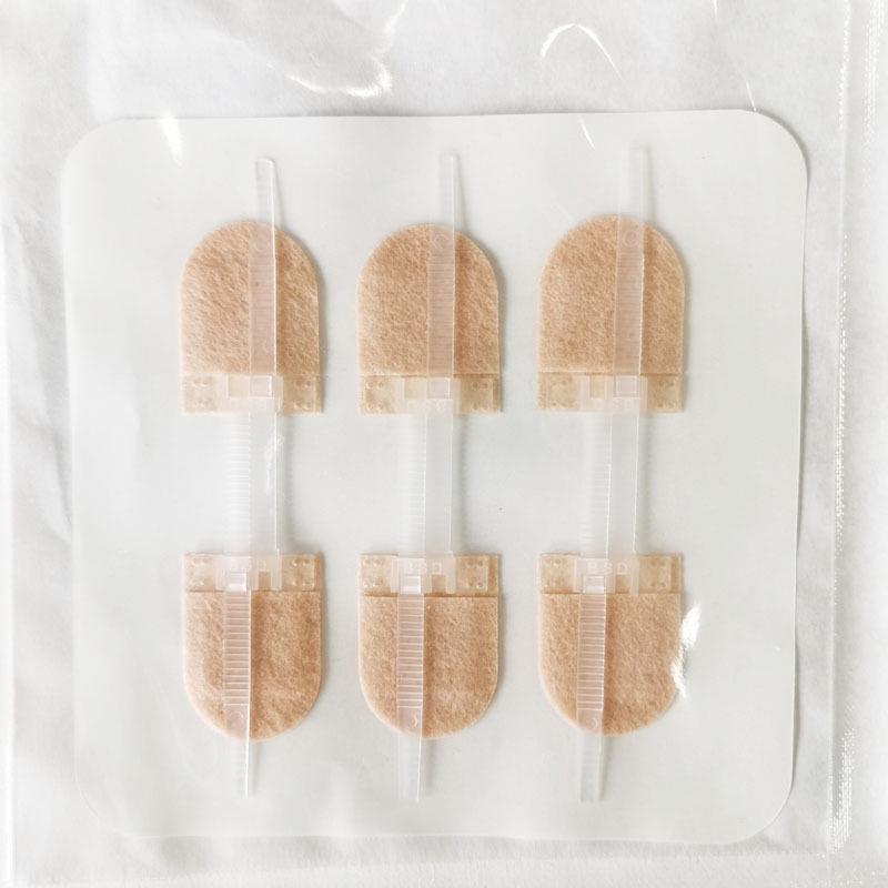 Zippered Suture-Free Tape Closure with Waterproof Patch