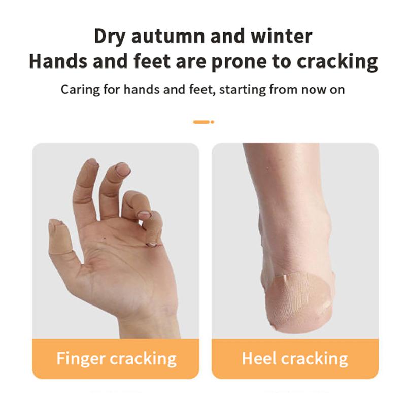 30/100Pcs Cracked Heel Hand Treatment Patches, Cracked Heel Hand Repair Bandage