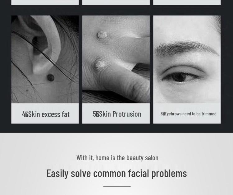 Portable Picosecond Laser Pen for Tattoo, Freckle, and Eyebrow Removal with Red & Blue Light