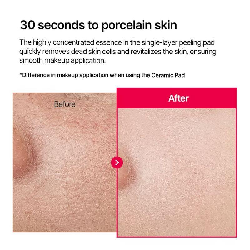 Parnell - Ceramic Pad