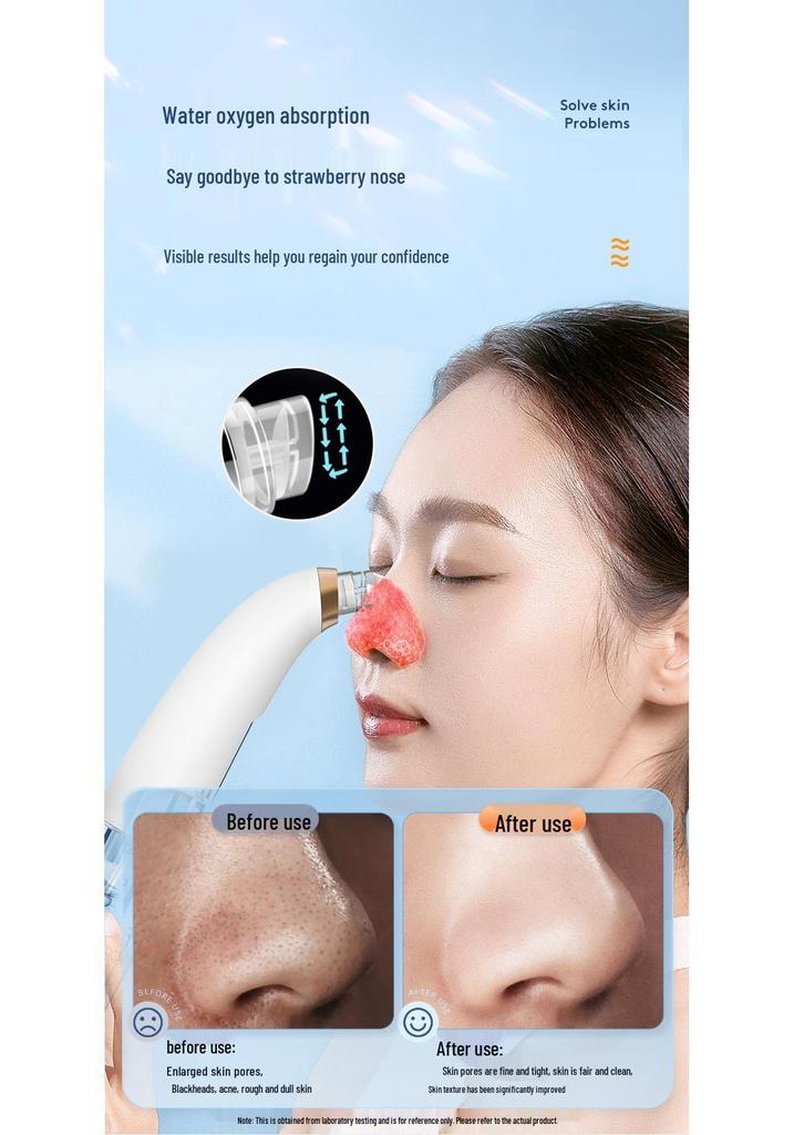 Electric Blackhead Suction Facial Cleaner with Small Bubble Technology