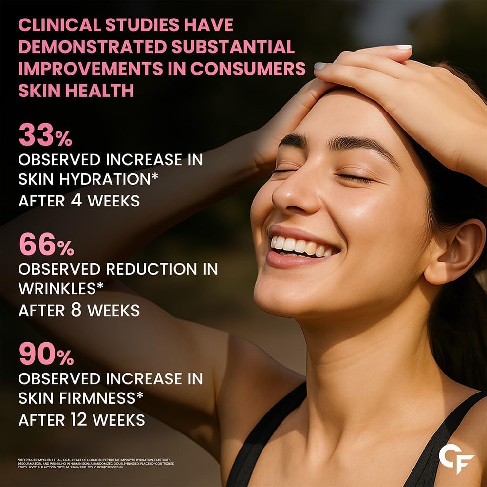 Carbamide Forte Multi-Kollagen-Peptid-Tabletten 90 | Typ I II III V X | Haut Haare Nägel Gelenke