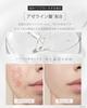 SLASH Foaming Facial Cleanser Clean Pores and Clogged Azelaic For Rough Made In Includes Facial Cleansing Net Men's [For Blackheads] Acid, CICA,