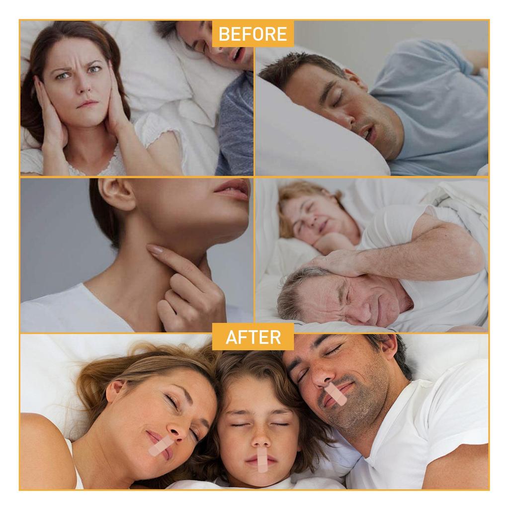 Stop Snoring Patch Improve Sleep Anti-Open Mouth Sleeping Snoring Snoring Adult Nighttime Stop Snoring Patch
