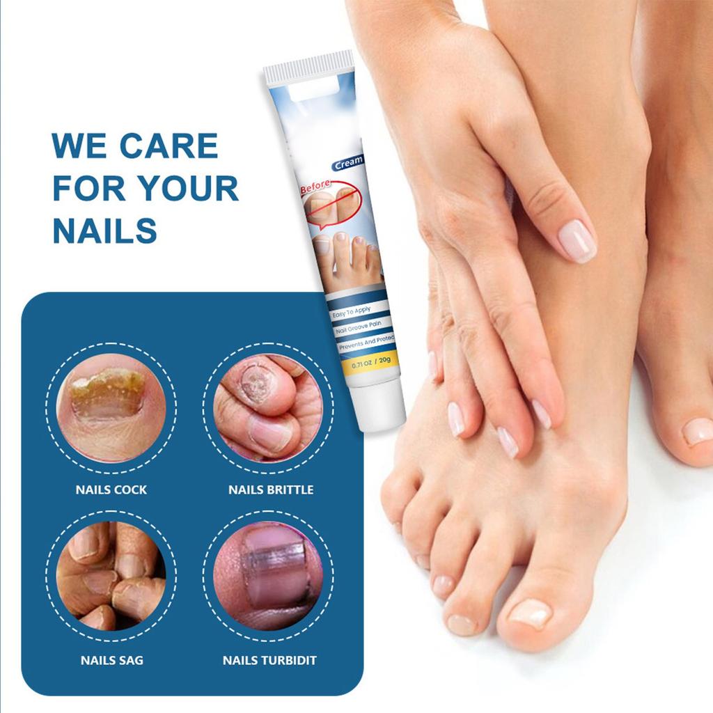 Nagelhärter-Creme, verbessert die Nagelhärte, hellt die Nagelfarbe auf