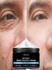 Face Essence Essential Oils Anti Wrinkle Anti-aging Lighten Spots Brightening Facial Skin Fade Remove Freckle Speckle Care