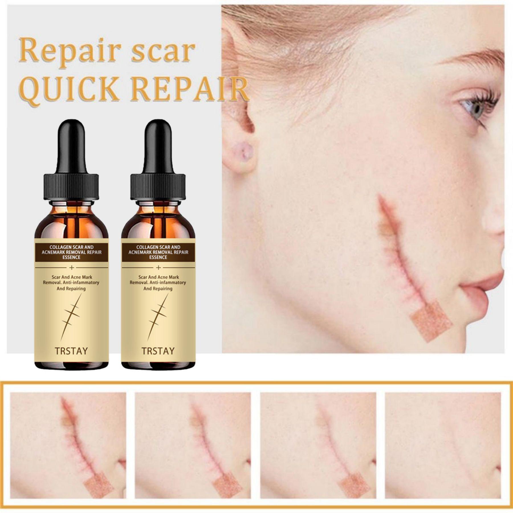 

Сыворотка для лица с ретинолом, увлажняющий ремонт, против старения, против морщин, эссенция для глубокого ухода за кожей, удаление шрамов от прыщей, отбеливающий крем для кожи