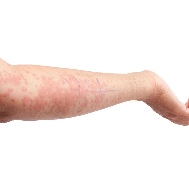 Crema restringente per i pori Elimina rapidamente i pori dilatati Rimuove i punti neri Rassoda il viso Prodotti per la cura della pelle liscia