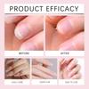 Nail Exfoliating Oil Watermelon Nail Polish Nourishing Nail Care Oil Reduces Dry Nails And Chapped Nails 30ml
