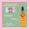 HOUSE OF BEAUTY Rosacea Face Oil with Pure cold pressed Rosehip & Vitamin E for Face Moisturizing, Suitable For Sensitive Skin Type - (30 ml)