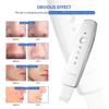 Ultrasonic Skin Scrubber Vibration Beauty Machine EMS Facial Peeling Ion Pore Clean Remove Blackhead Exfoliation