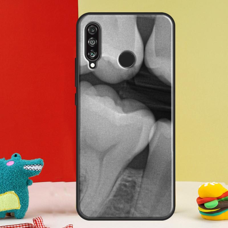 Dentist Dental Dent Tooth For Huawei Nova 12s 12i 11i 8i 9 10 SE Y91 Y90 Y60 Y70 Y72 Y61 P20 P40 P30 Lite P60 Pro Case