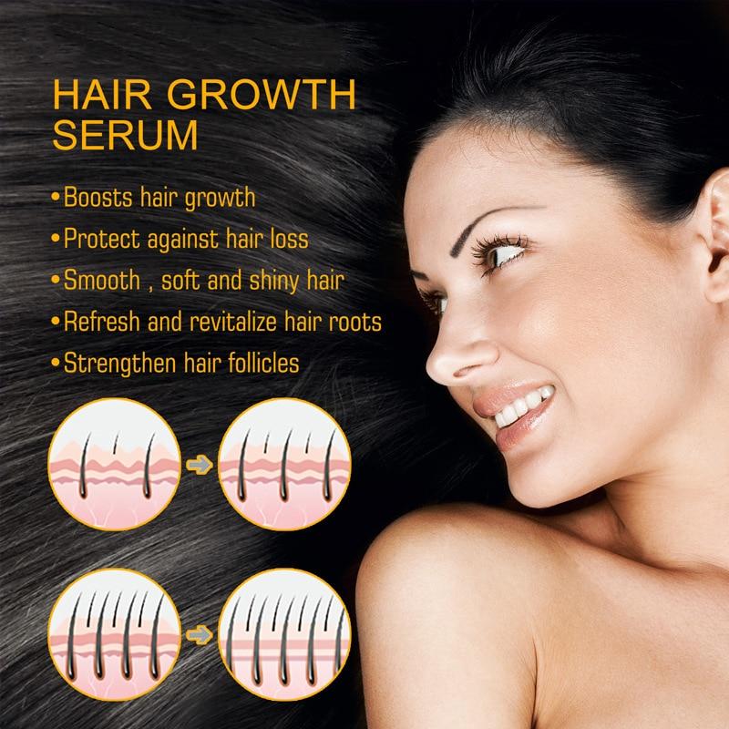 Hair Growth Serum 30ml - Anti-Hair Loss Scalp Treatment for Thicker Stronger Hair Follicles & Fast Growth