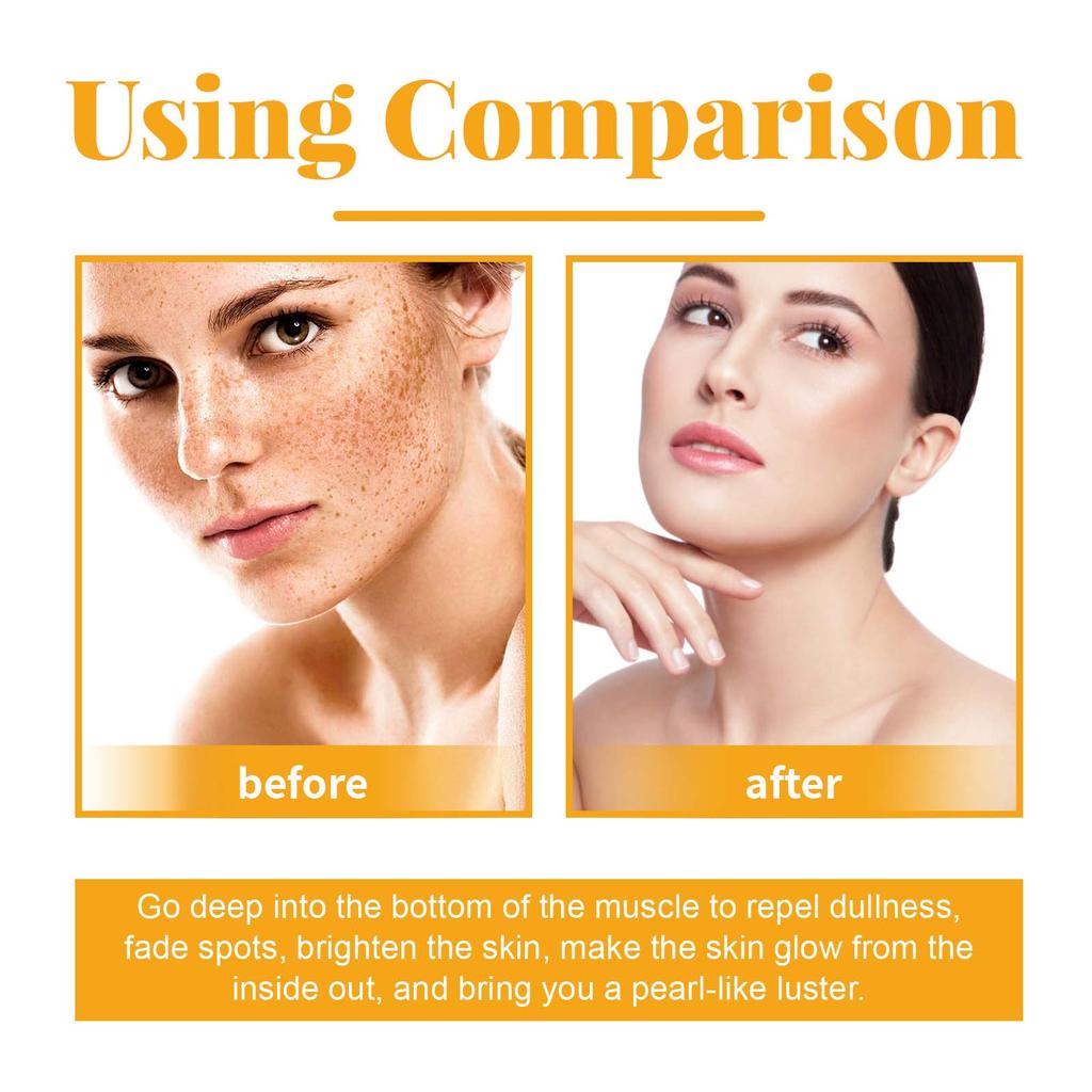 OUHOE Fruit Acid Facial & Body Serum Series Hydrates & Moisturizes Nourishes & Brightens Fades Dark Spots Suitable for Whole Body 100ml