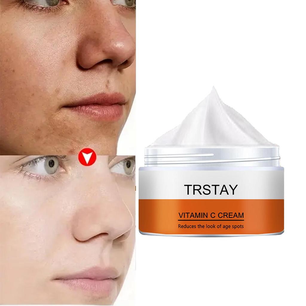 TRSTAY Vitamin C For Face Cream Pigments Dark Spots Removal Whitening Facial Cream Lightening Skin Care Products Beauty Health