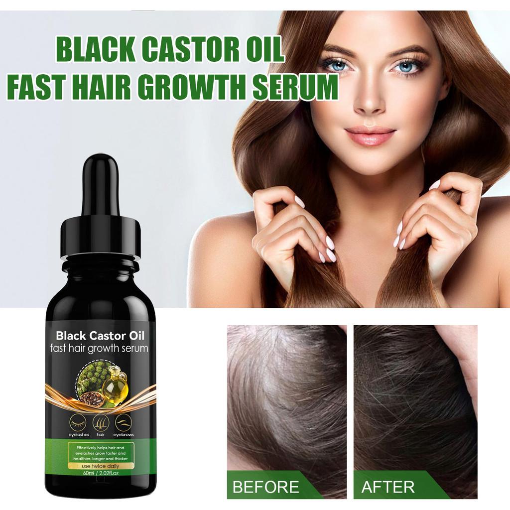 Jaysuing Castor Oil Hair Growth Essence Nourishing Thickening Strengthening Formula