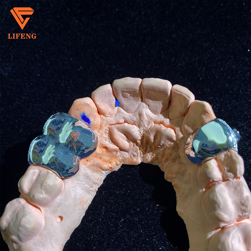 Lifeng Jewelry Custom Luxury Grillz Personality Design VVS Moissanite Hiphop Diamond Grillz Sterling Silver Rapper Teeth Grillz