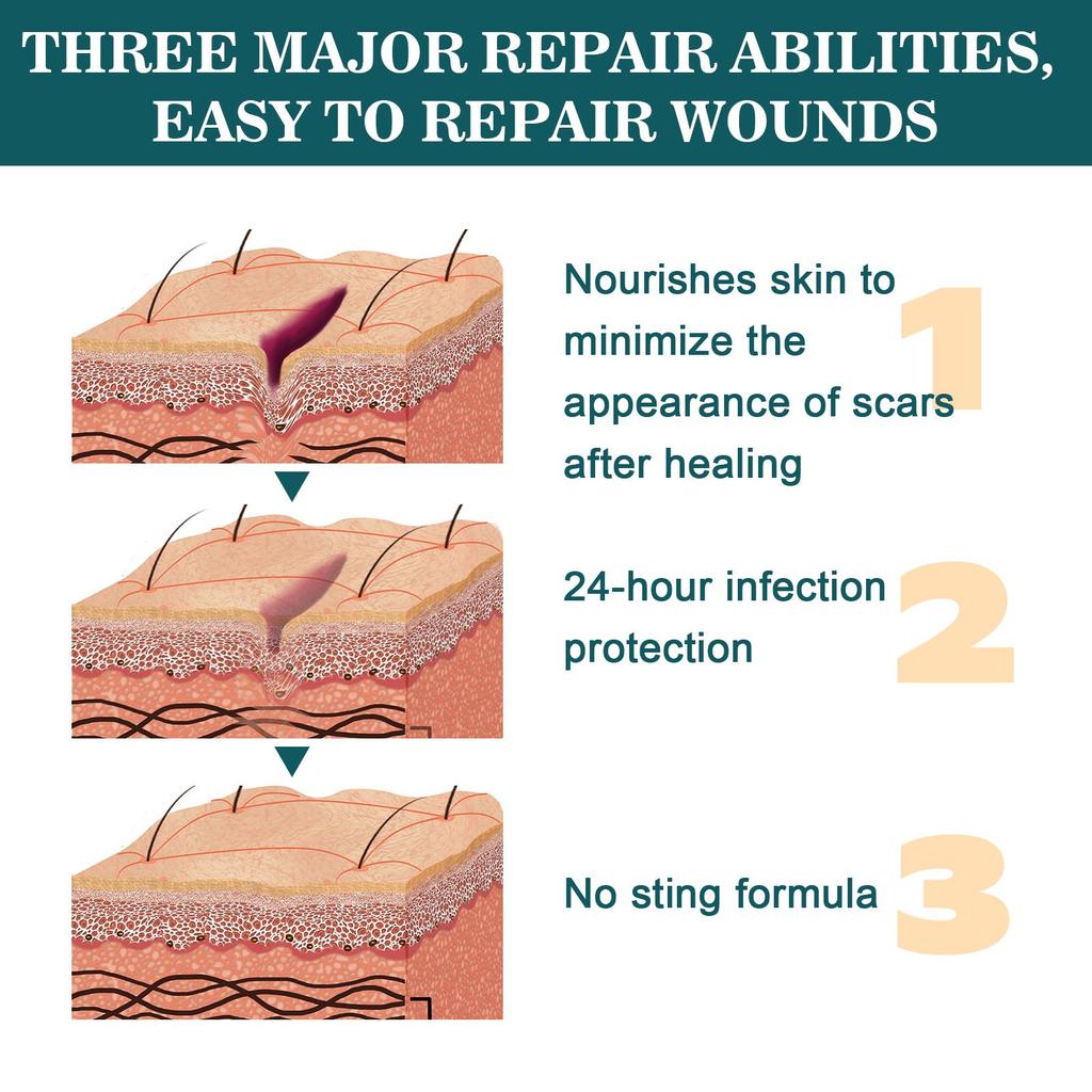 Scar Fade Ointment Scratches Recovery Relieves Skin Abrasions Wounds Fade Scars Moisturizing Skin Repair Care Cream
