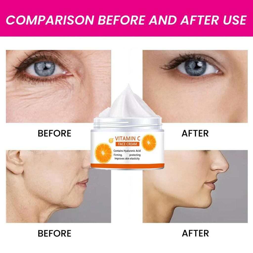 Vitamin C Cream To Fade Fine Lines Women's Face Cream Anti-aging Face Cream Women's Face Cream