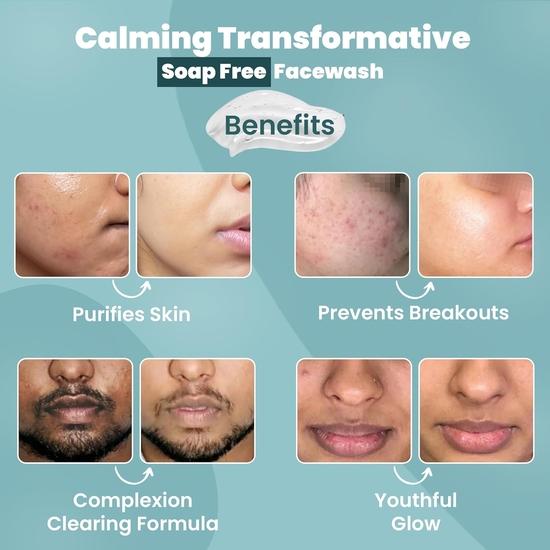 WildOak Haldi, Kesar & Aloe Vera Face Wash | Ayurvedic Face Cleanser for Acne, Pimples & Pore Cleansing | Kills 99% Acne Germs| 100ml