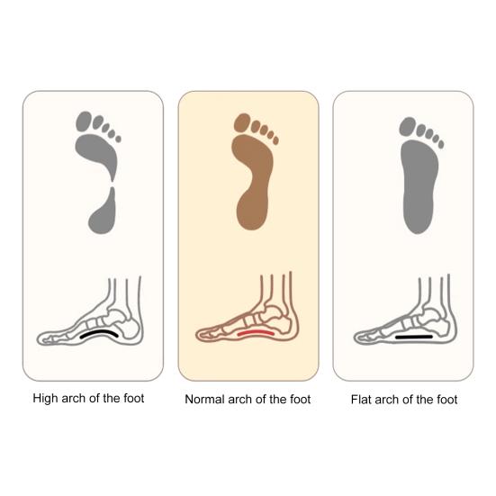 1 Pair Foot Arch Trainer Enhanced Durability Support Flat Foot Strengthener Exercise Rehab Recovery Foot Muscle Strengthening Support