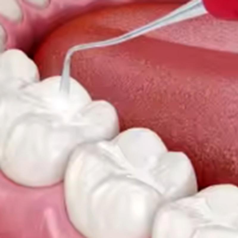 Zahnmedizinische doppelseitige Silikonharz-Füllspatel Kompositfüllung Chirurgische Instrumente Füllungen Zahnarztzubehör Zahnarztwerkzeug