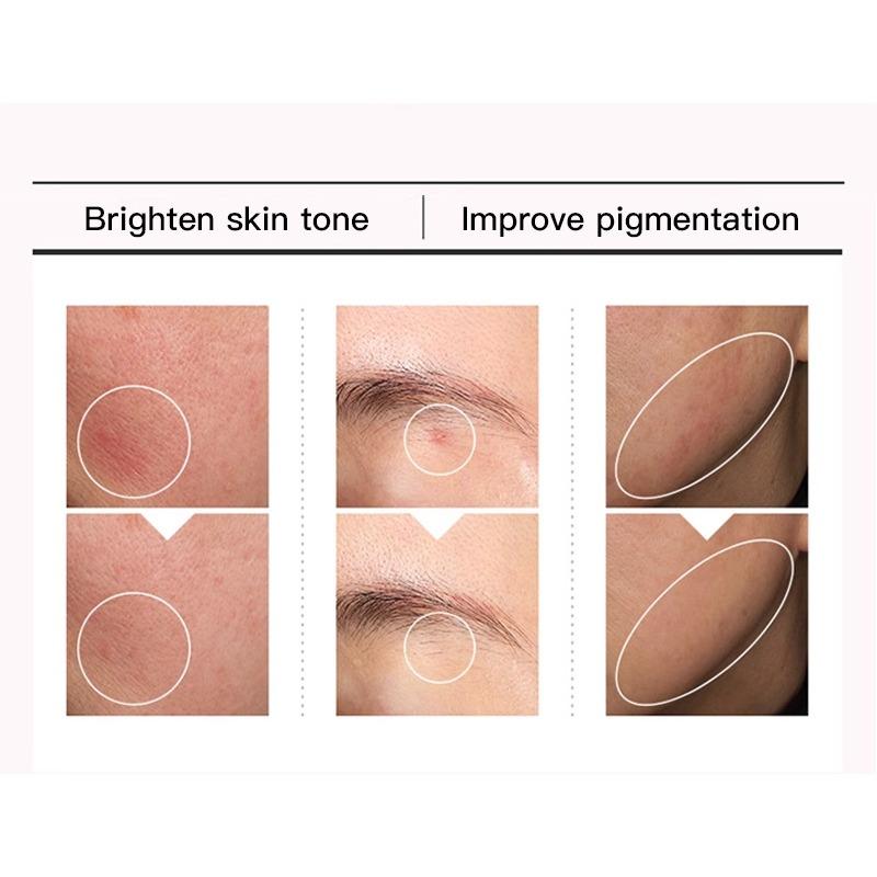 10% Niacinamid + 4% Hyaluronsäure Gesichtsessenz Ceramid, Vitamin B12