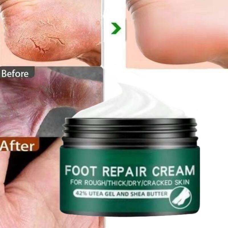 Effective Odor Treatment Nourishing Anti Cracking Cream Skin Care Products Dead Skin Remover Chapped Repair Cream
