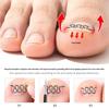 Stretchable Small Invisible Ingrown Toenail Patch with Nickel Alloy Coil Wire for Nail Correction, Fits in Shoes.